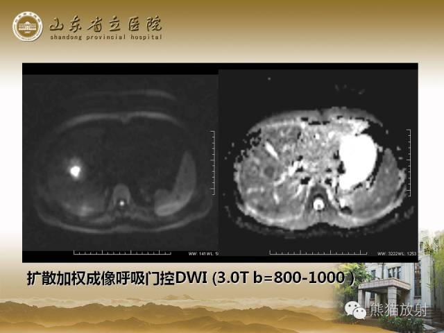 【PPT】肝脏影像学培训内容