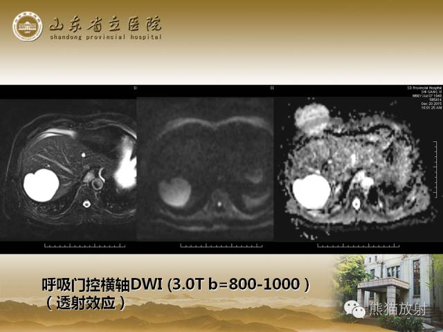 【PPT】肝脏影像学培训内容