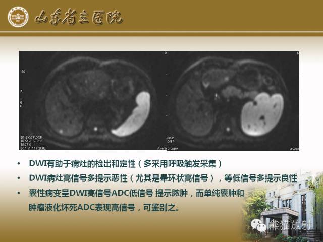 【PPT】肝脏影像学培训内容