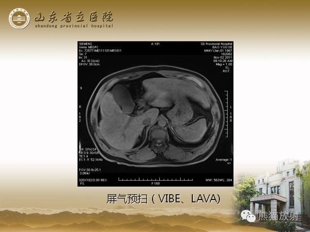 【PPT】肝脏影像学培训内容