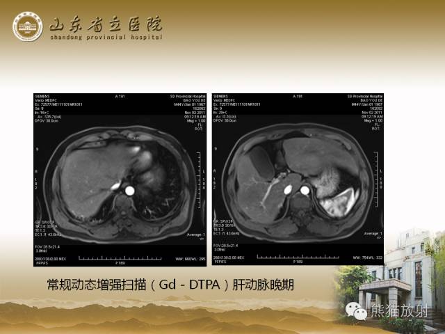 【PPT】肝脏影像学培训内容