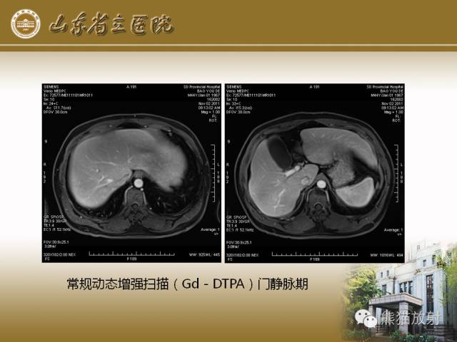 【PPT】肝脏影像学培训内容