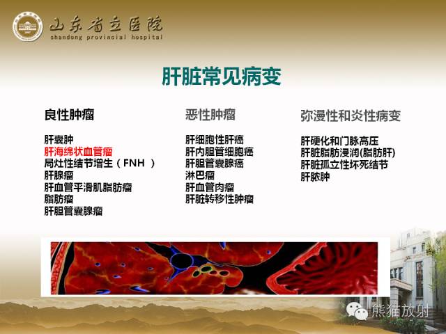 【PPT】肝脏影像学培训内容