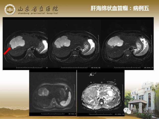 【PPT】肝脏影像学培训内容