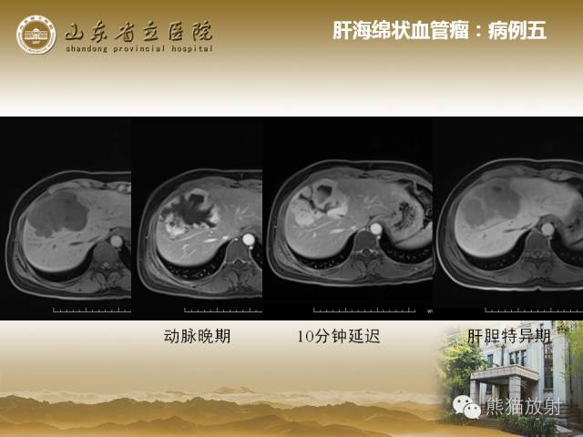 【PPT】肝脏影像学培训内容
