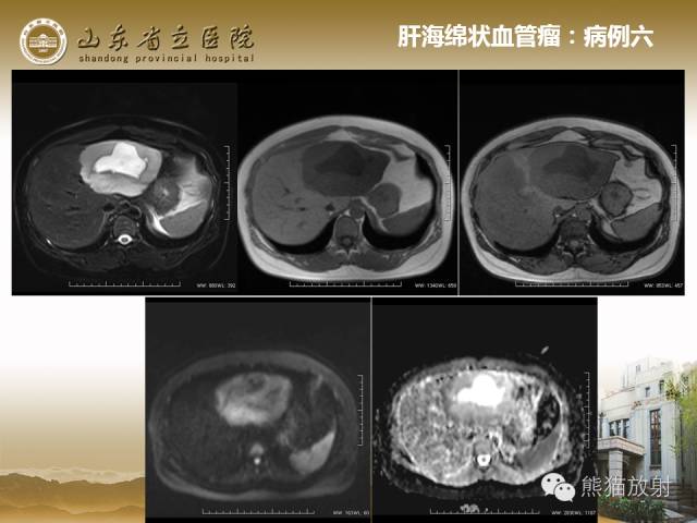【PPT】肝脏影像学培训内容