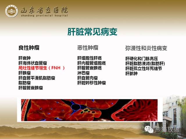 【PPT】肝脏影像学培训内容