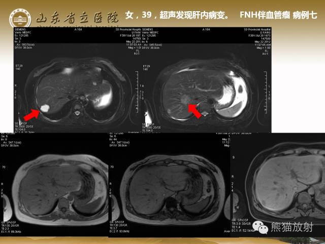 【PPT】肝脏影像学培训内容
