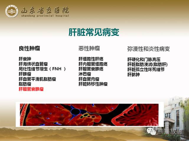 【PPT】肝脏影像学培训内容