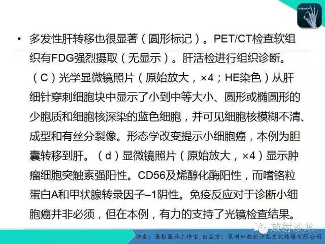 【PPT】肺外小细胞癌 影像学特点及影像-病理对照