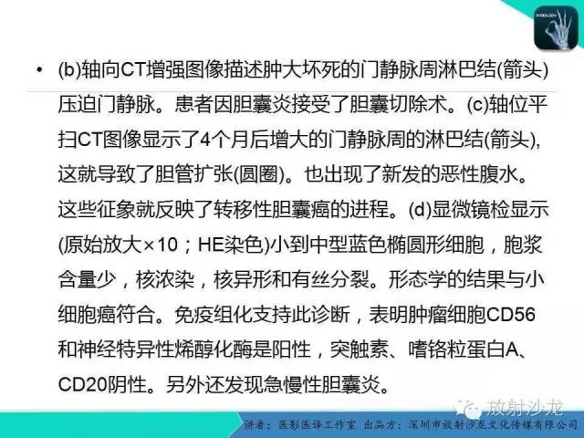 【PPT】肺外小细胞癌 影像学特点及影像-病理对照