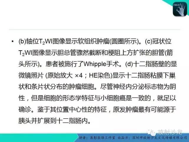 【PPT】肺外小细胞癌 影像学特点及影像-病理对照