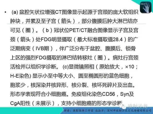 【PPT】肺外小细胞癌 影像学特点及影像-病理对照