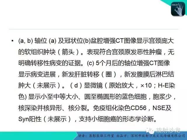 【PPT】肺外小细胞癌 影像学特点及影像-病理对照