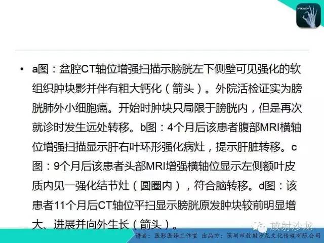 【PPT】肺外小细胞癌 影像学特点及影像-病理对照