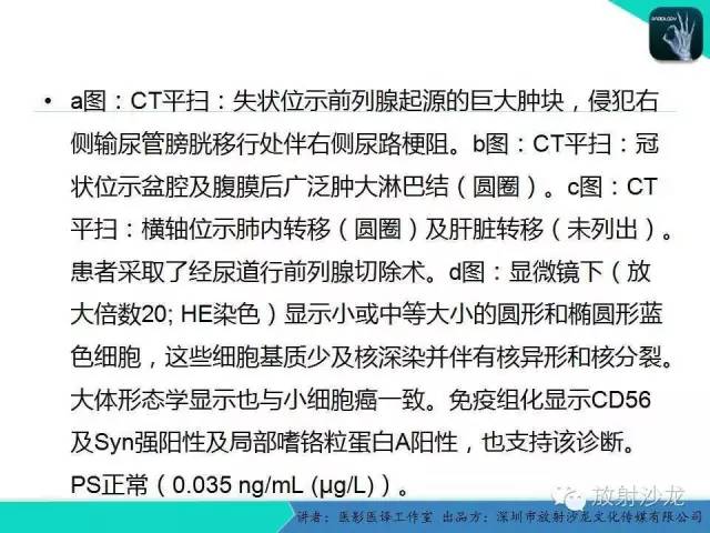 【PPT】肺外小细胞癌 影像学特点及影像-病理对照
