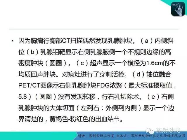 【PPT】肺外小细胞癌 影像学特点及影像-病理对照