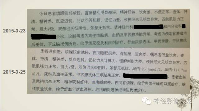 【病例】渗透性脱髓鞘综合征1例MR影像表现与鉴别