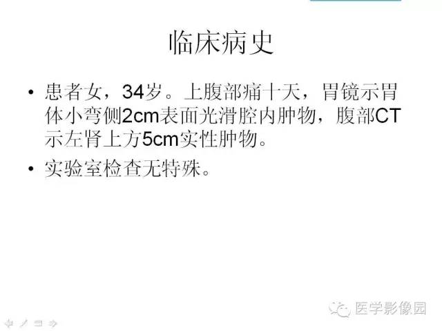 【病例】腹膜后静脉性海绵状血管瘤1例CT影像表现