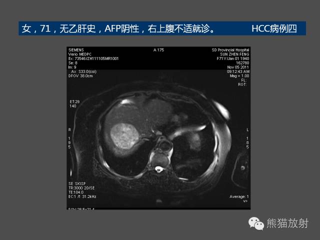 【PPT】肝脏影像学培训内容