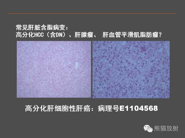 【PPT】肝脏影像学培训内容