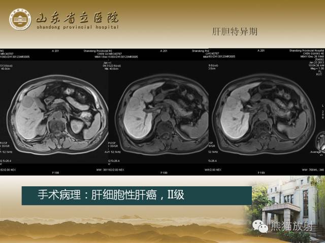 【PPT】肝脏影像学培训内容
