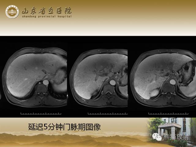 【PPT】肝脏影像学培训内容
