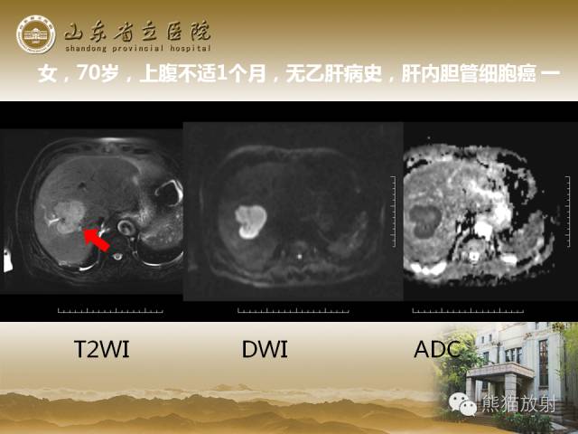 【PPT】肝脏影像学培训内容