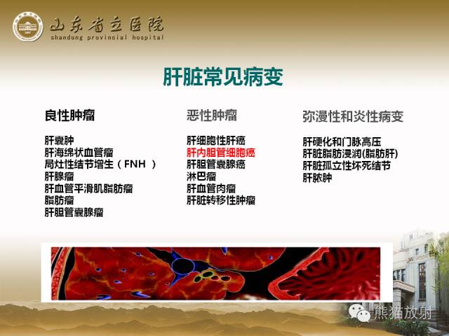 【PPT】肝脏影像学培训内容