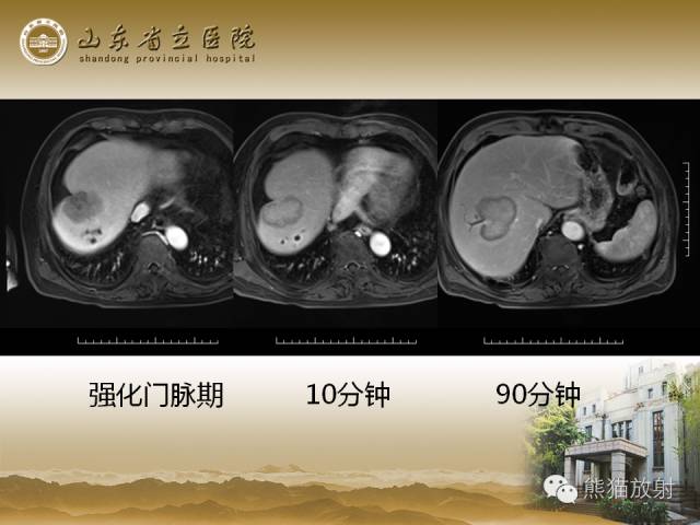 【PPT】肝脏影像学培训内容