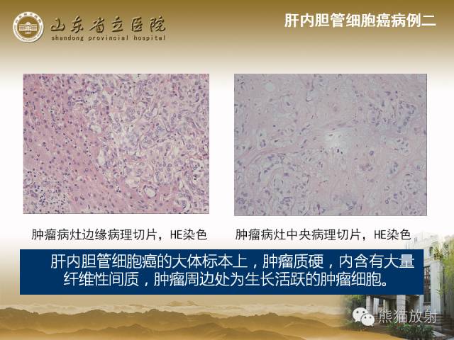 【PPT】肝脏影像学培训内容