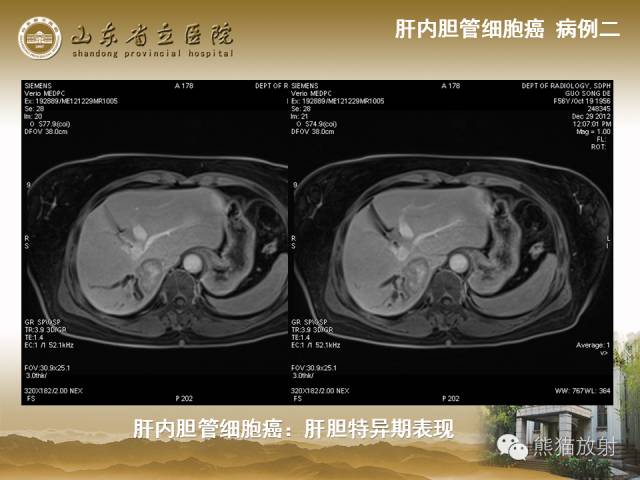 【PPT】肝脏影像学培训内容