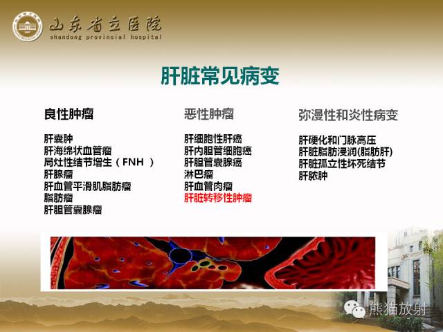 【PPT】肝脏影像学培训内容