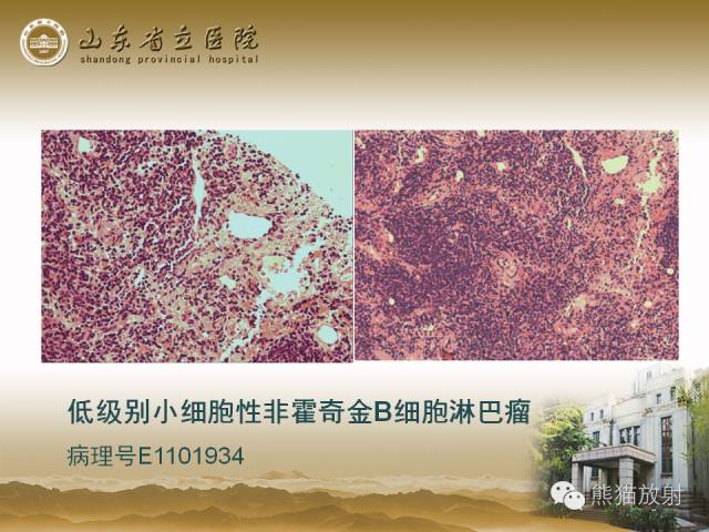 【PPT】肝脏影像学培训内容
