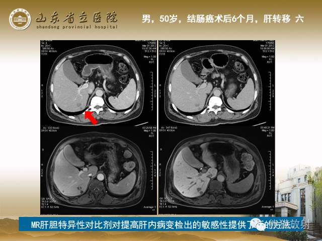 【PPT】肝脏影像学培训内容