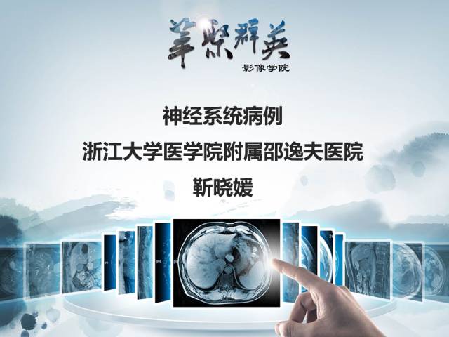 【病例】视神经脊髓炎1例MR影像表现