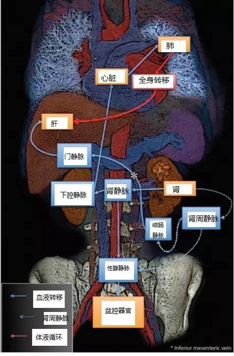 肾癌转移的影像评价 肾癌转移的影像评价