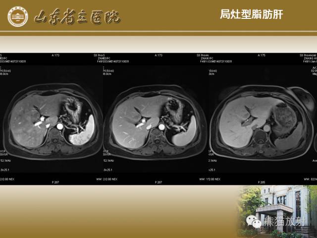 【PPT】肝脏影像学培训内容