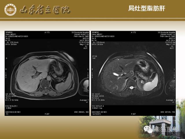 【PPT】肝脏影像学培训内容