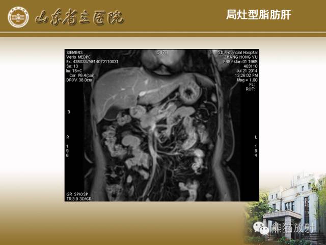【PPT】肝脏影像学培训内容
