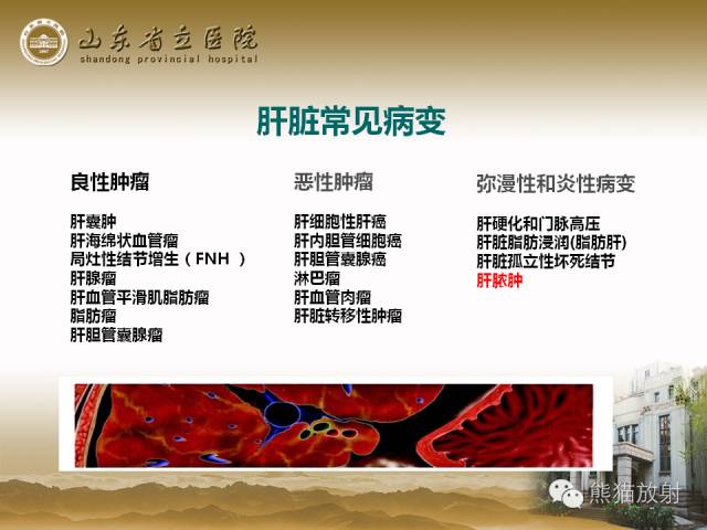 【PPT】肝脏影像学培训内容