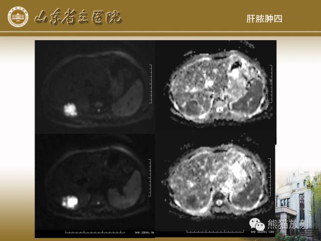 【PPT】肝脏影像学培训内容