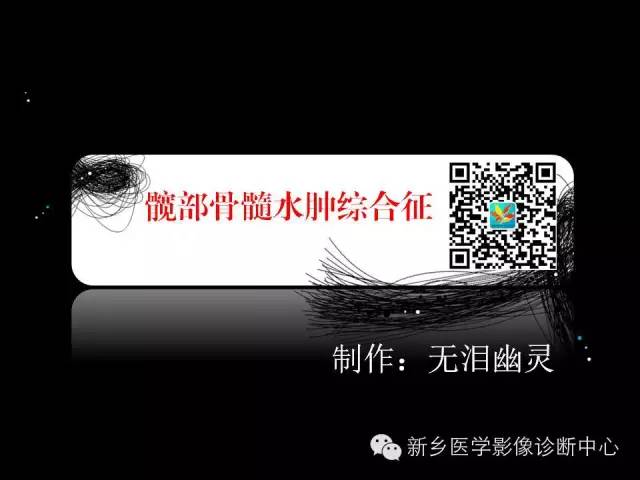 【PPT】髋部骨髓水肿综合征