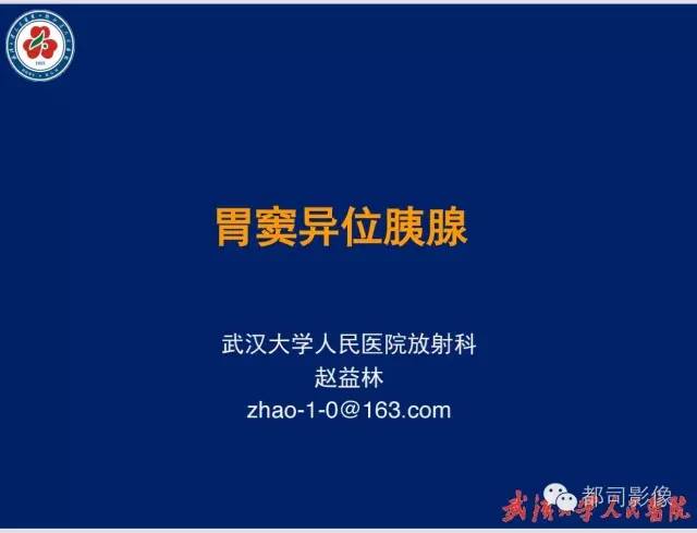 【病例】胃窦异位胰腺1例CT影像表现