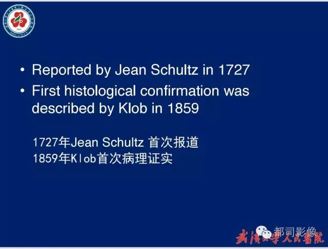 【病例】胃窦异位胰腺1例CT影像表现