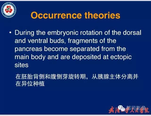 【病例】胃窦异位胰腺1例CT影像表现