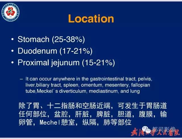 【病例】胃窦异位胰腺1例CT影像表现