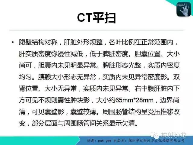 【病例】小肠重复畸形1例CT影像表现