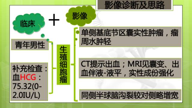 【病例】右侧基底节区生殖细胞瘤1例CT及MR影像表现