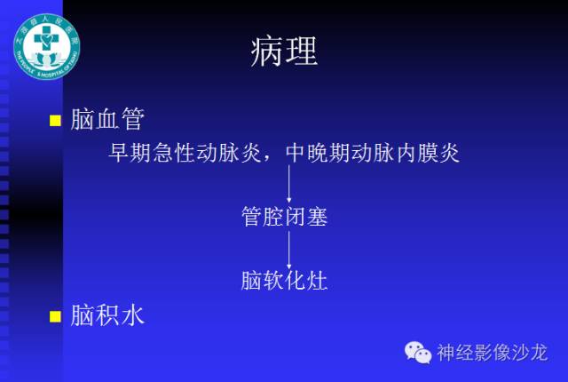 【病例】结核性脑膜炎1例MR影像表现